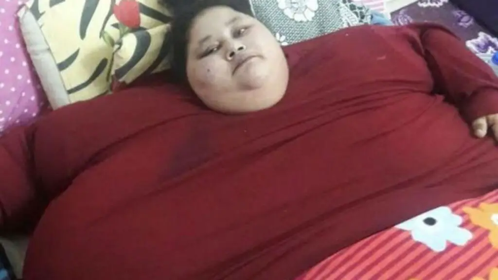 Top 10 Fattest Person in the World 2024 That Are Alive Right Now