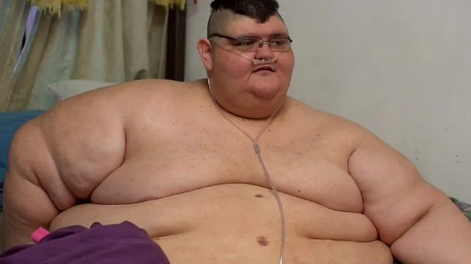 Top 10 Fattest Person in the World